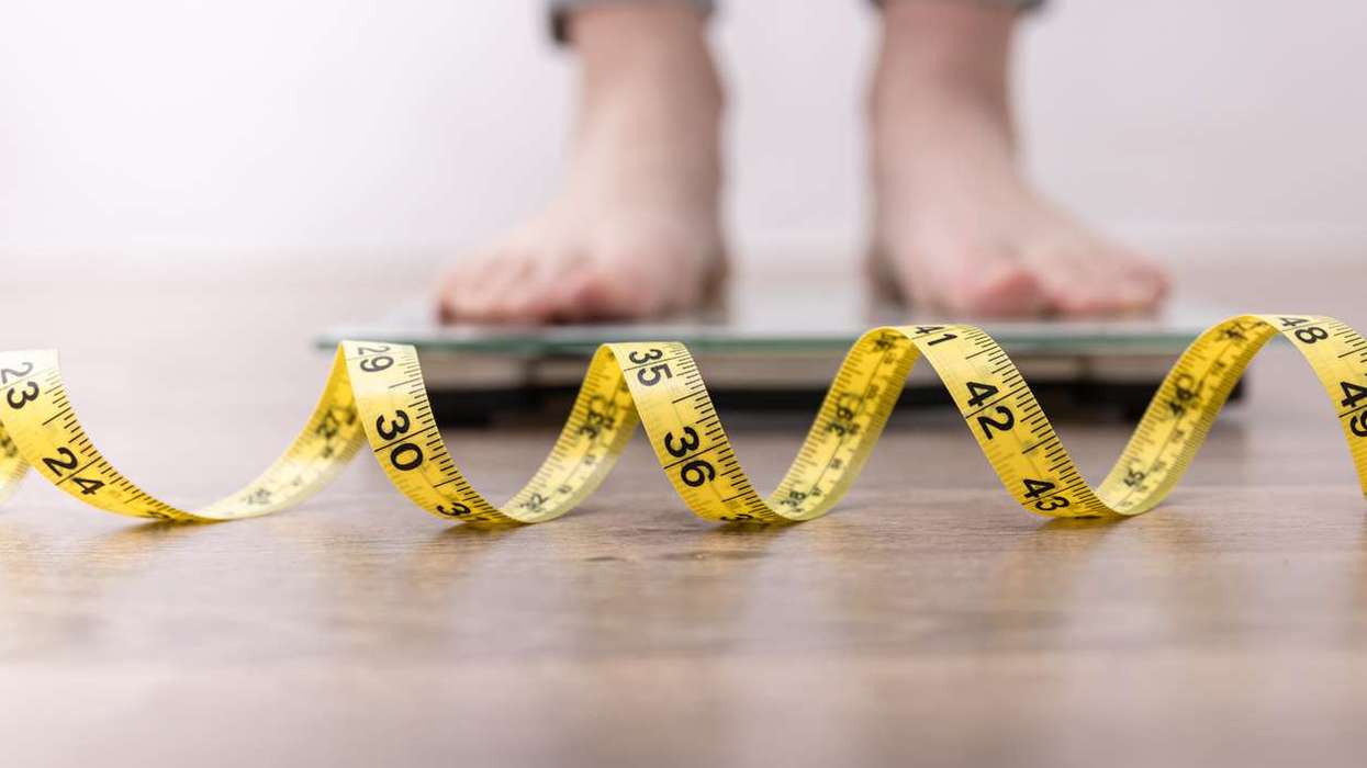 obesity